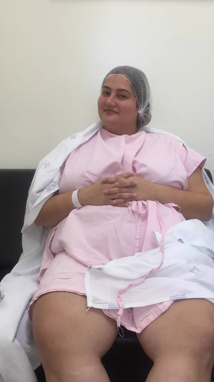 Foto antes do caso 2 de bypass gástrico